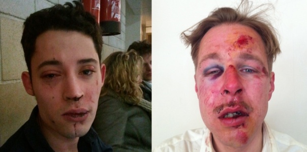 On April 7, 2013 Wilfred de Bruijn and Olivier Couderc, a young homosexual couple living in Paris, were savagely attacked on the street on homophobic grounds as they were going home late at night. Since the newly-elected Socialist Party parliamentary majority had begun examining a bill on same-sex marriage in late 2012, French President François Hollande and his government had faced demonstrations, sometimes violent, by opponents to gay rights who wanted them to drop the bill. The attack on Wilfred and Olivier resulted in national outrage and the opponents to the government-proposed bill were widely blamed for it.  Eventually, on May 17, 2013 the French Parliament went ahead and did pass the law extending the right to marriage to same-sex couples.